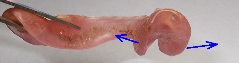 dentiera resina DSCN6444_2 frecce.JPG